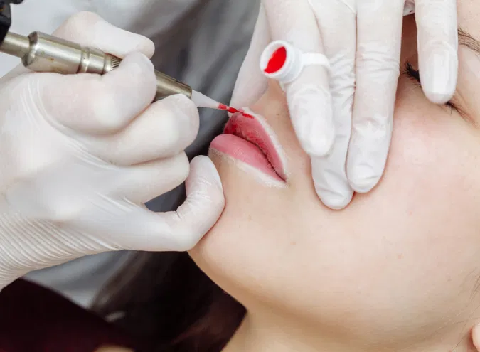 Revitalize Your Smile With Lip Pigmentation and Color Correction