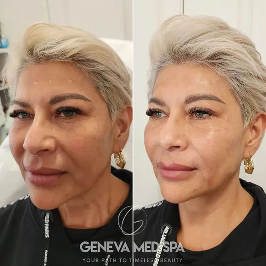 Geneva Med Spa aesthetic clinic in Frisco TX