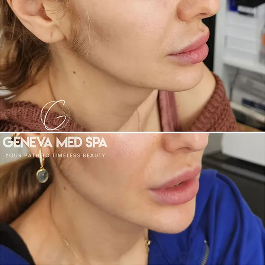 Geneva-Med-Spa-aesthetic-clinic-in-Frisco-TX_G_11_result