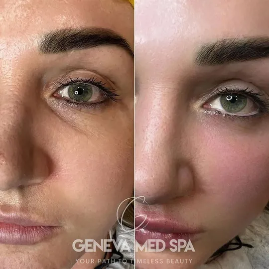 Geneva Med Spa aesthetic clinic in Frisco TX