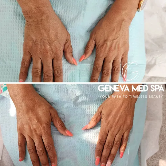 Geneva Med Spa aesthetic clinic in Frisco TX