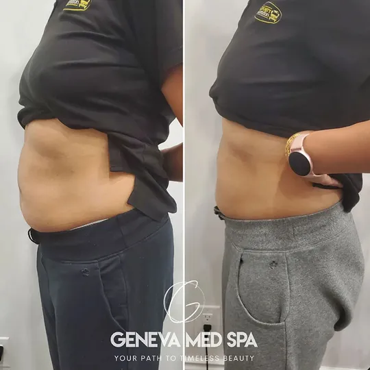 Geneva Med Spa aesthetic clinic in Frisco TX
