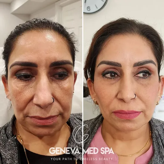 Geneva Med Spa aesthetic clinic in Frisco TX