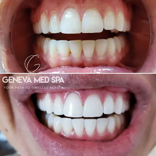 Geneva Med Spa aesthetic clinic in Frisco TX