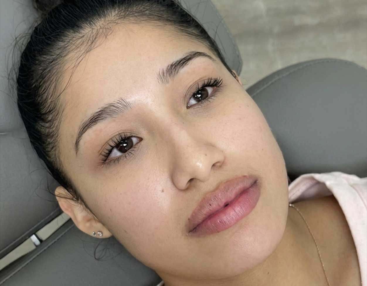 HydraFacial-Frisco-gallery-2