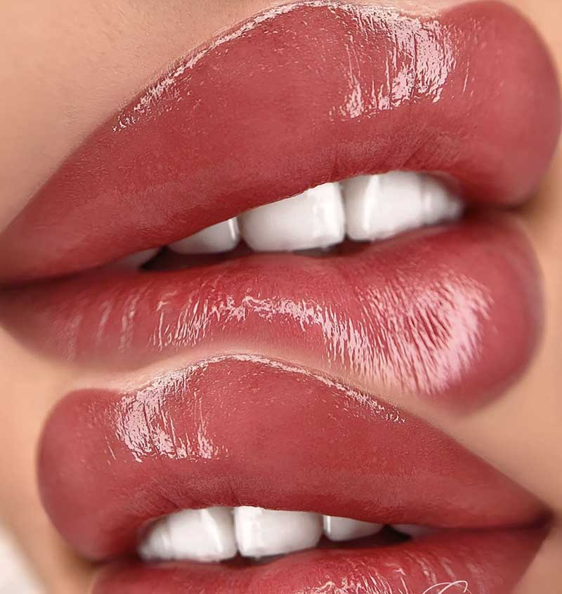 Lip Pigmentation/Lip Color Correction Frisco, TX | Geneva Med Spa