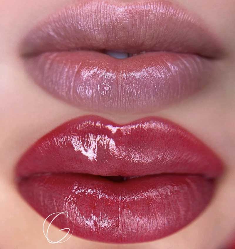 Lip Pigmentation/Lip Color Correction Frisco, TX | Geneva Med Spa