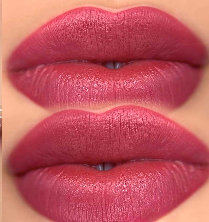 Lip Pigmentation/Lip Color Correction Frisco, TX | Geneva Med Spa