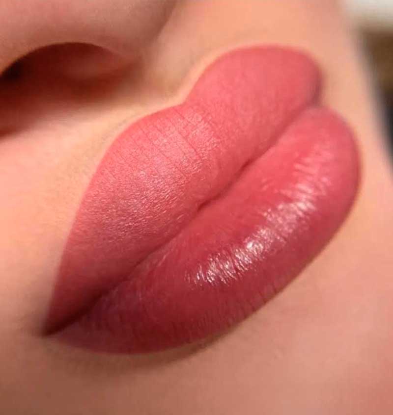 Lip Pigmentation/Lip Color Correction Frisco, TX | Geneva Med Spa