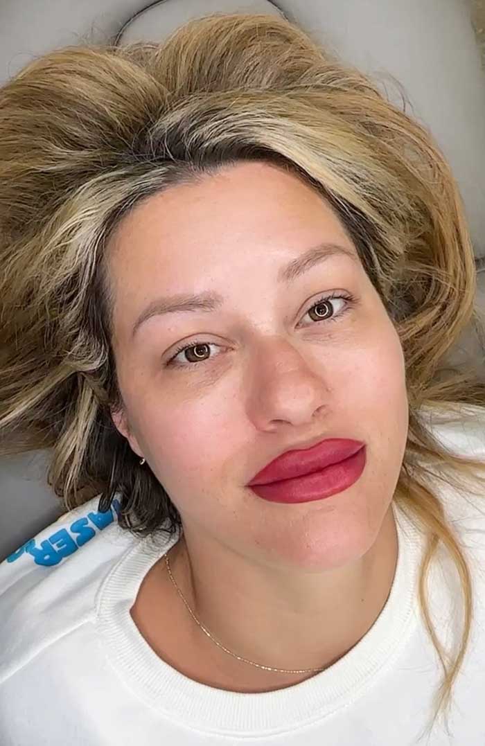Lip Pigmentation/Lip Color Correction Frisco, TX | Geneva Med Spa