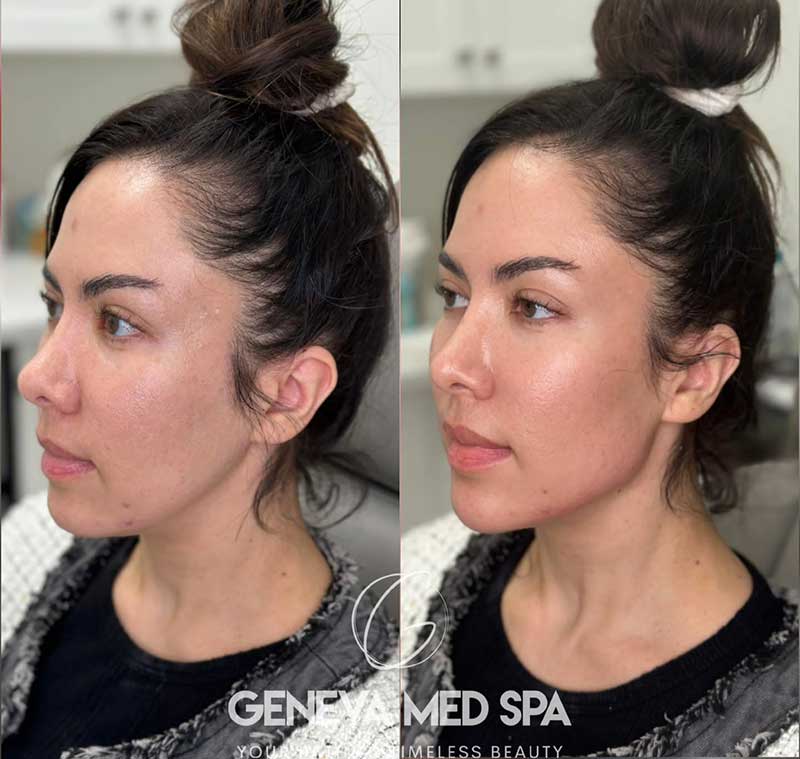PDGF-Treatment-Frisco-Texas-gallery