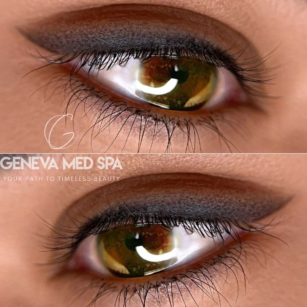 Permanent-Eyeliner-Frisco-gallery-2