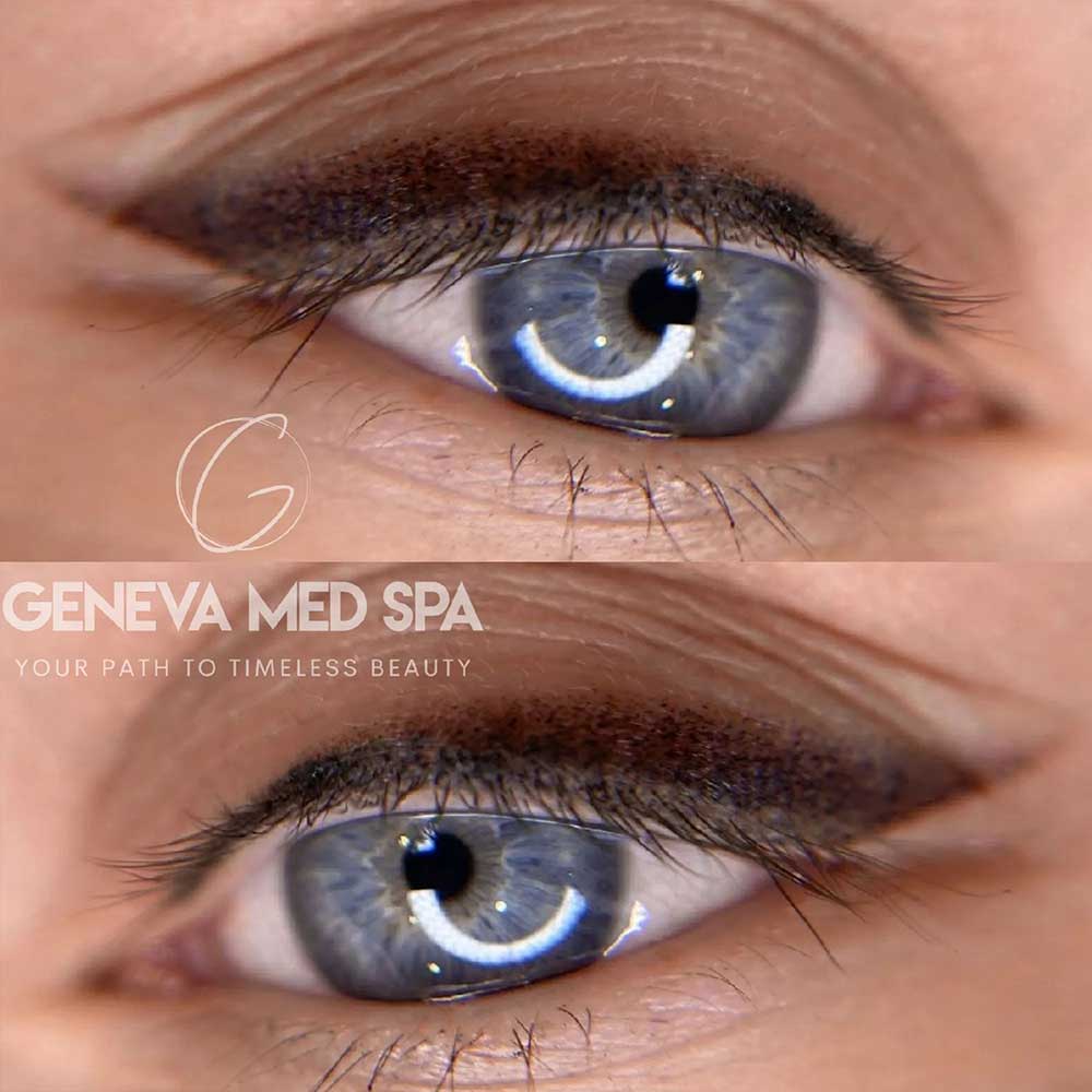 Permanent-Eyeliner-Frisco-gallery-5