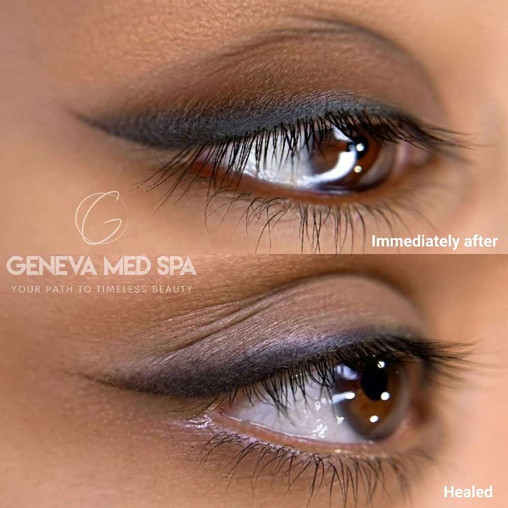 Permanent-Eyeliner-Frisco-gallery